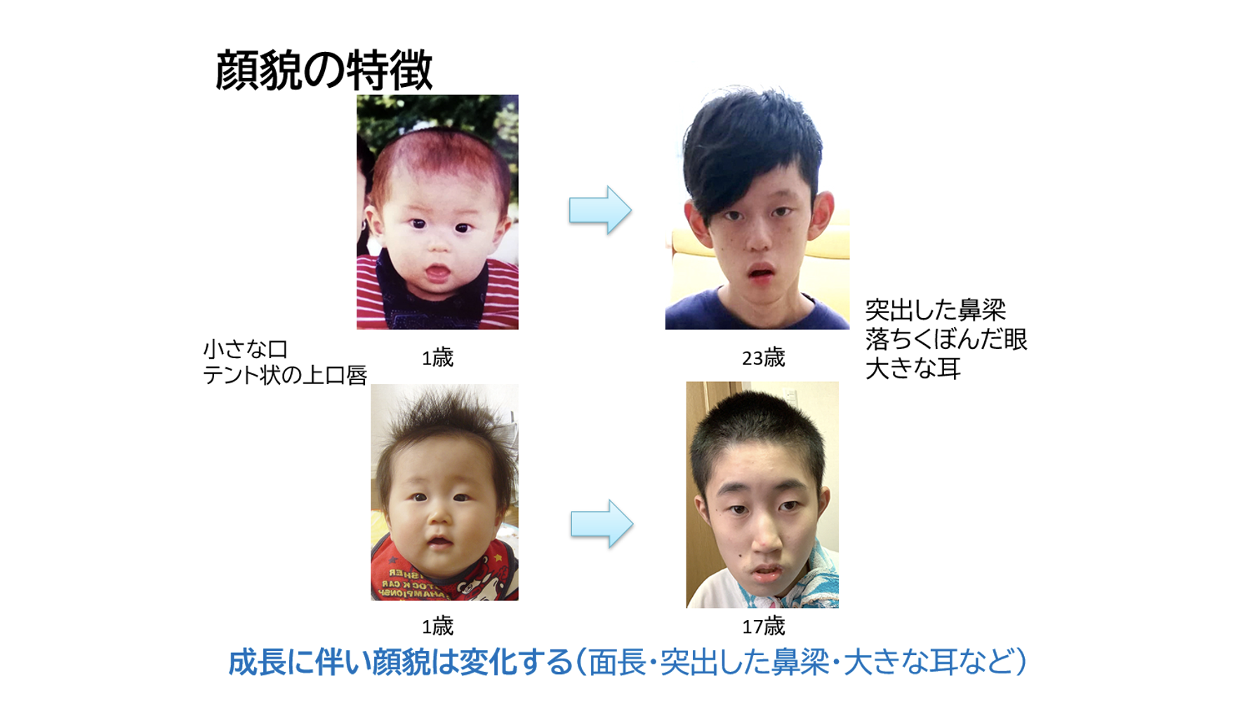 竹口 諒先生の論文が Journal Of The Neurological Sciencesにアクセプトされました 旭川医大小児科 竹口 諒先生の論文が Journal Of The Neurological Sciencesにアクセプトされました 旭川医大小児科